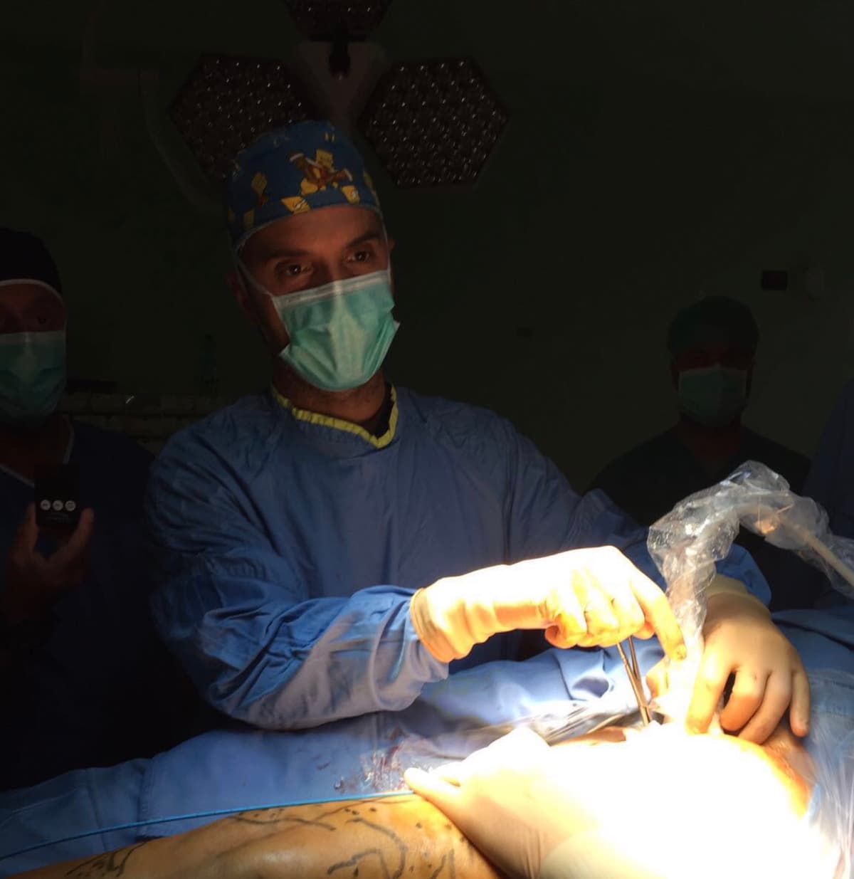 Minimally invasive surgery with saphenous sparing.
